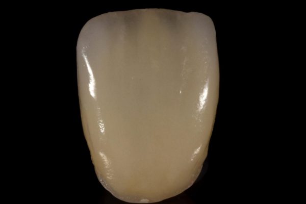 4-Carlos Ry 01 dientes de lujo alta definición realistica caracterización a medida