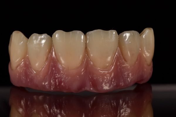 5-Carlos Ry 01 dientes de lujo alta definición realistica caracterización a medida